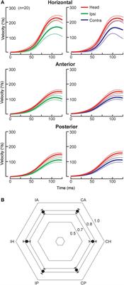 Central Lesions With Selective Semicircular Canal Involvement Mimicking Bilateral Vestibulopathy